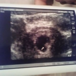 Meet your Posher, Annette